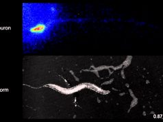 ‘Sonogenetics’ allows brain cells to be controlled by sound waves